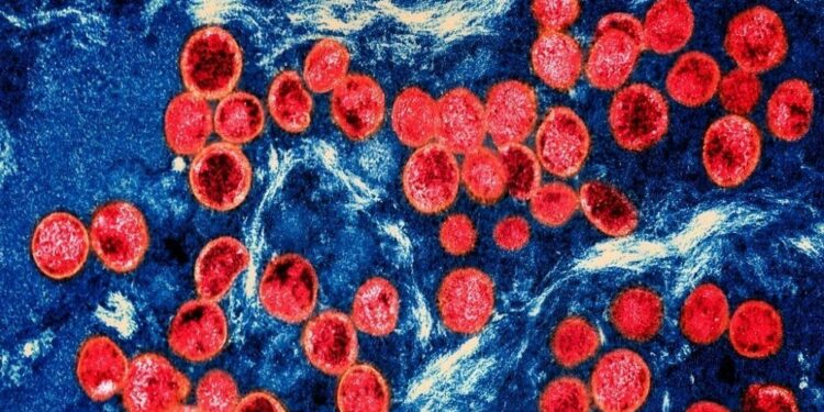 Colourised transmission electron micrograph of mpox virus particles (red) found within an infected cell (blue) cultured in the laboratory. (NIH-NIAID/IMAGE POINT FR/BSIP/Universal Images Group via Getty Images)