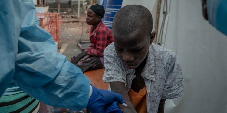 Doctors take samples from a patient at the mpox treatment centre in Nyiragongo general referral hospital, north of Goma in the Democratic Republic of Congo, on 16 August 2024. (Guerchom Ndebo/ AFP)