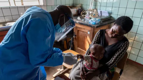 Glody Murhabazi Baby is attended by doctor in Lwiro hospital, DR Congo