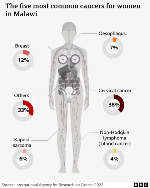 A  diagram of a human body which shows the five most common cancers for women in Malawi. Cervical cancer is the most common, followed by breast, oesophagus, kaposi sarcoma and non-hodgkin lymphoma. 