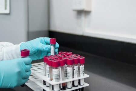 Lab results expected soon in DR Congo’s mystery outbreak – cidrap.umn.edu