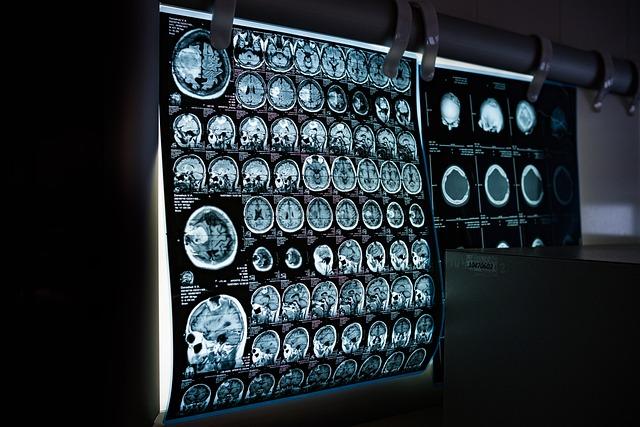Future Prospects: how AI Medical Imaging Can Shape Healthcare in West Africa