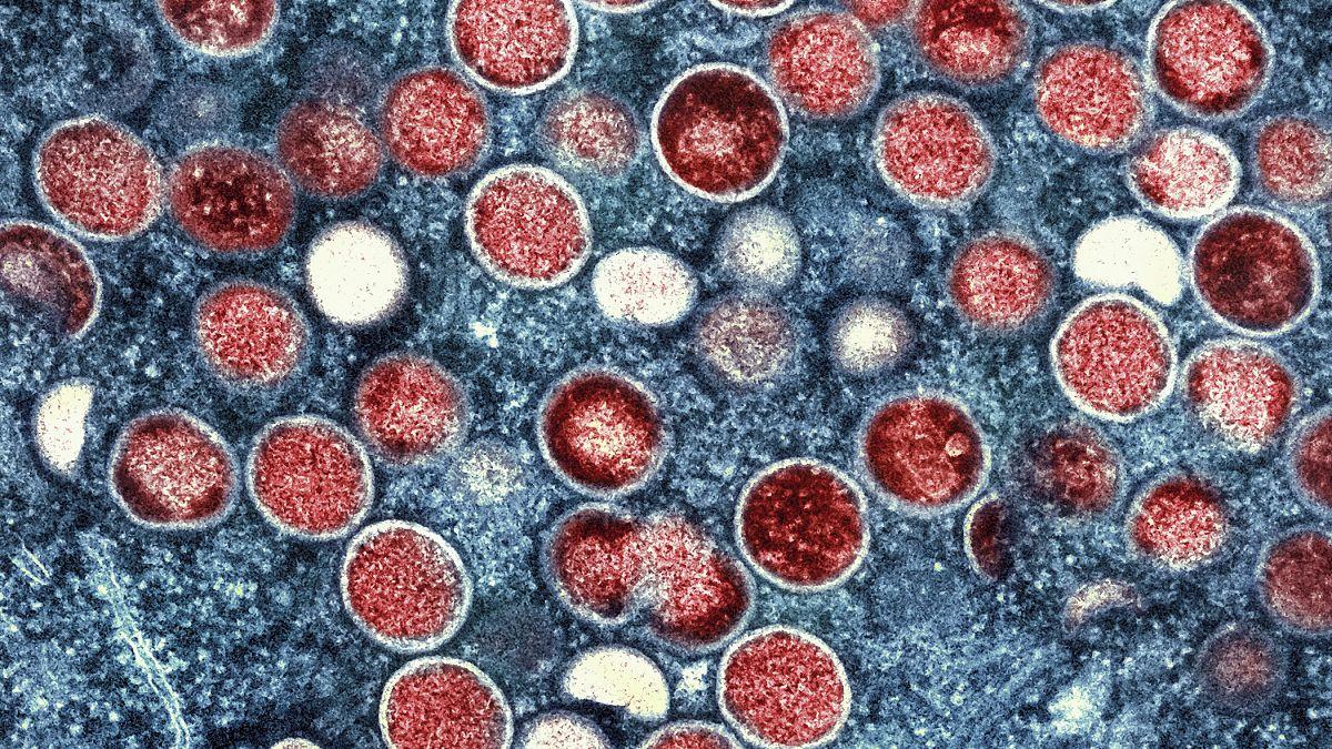 Mpox Outbreaks Trigger Urgent Health Response in Kenya and Central African‍ Republic