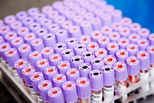 best​ Practices and Innovations in Laboratory​ Techniques for Africa